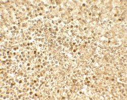 SREBP2 Antibody - BSA Free, Novus Biologicals 0.1mg; Unlabeled:Antibodies,