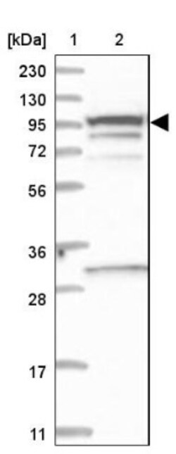 SREC-II/SCARF2 Antibody, Novus Biologicals 25 &mu;L; Unlabeled:Antibodies,