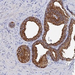 SRFBP1 Antibody, Novus Biologicals 0.1mL; Unlabeled:Antibodies, Polyclonal