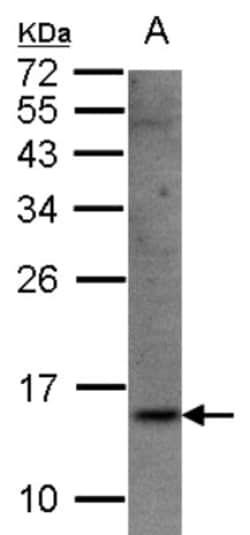 SRP14 Antibody, Novus Biologicals 0.1mg; Unlabeled:Antibodies, Polyclonal