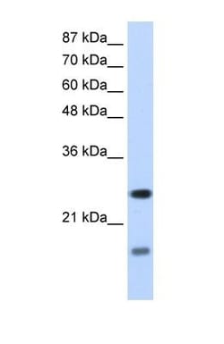 SRP14 Antibody, Novus Biologicals 0.1mg; Unlabeled:Antibodies, Polyclonal