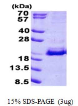 Novus Biologicals&trade;&nbsp;Recombinant Human SRP19 His Protein
