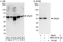 SRp55 Antibody, Novus Biologicals 0.1mg; Unlabeled:Antistoffer