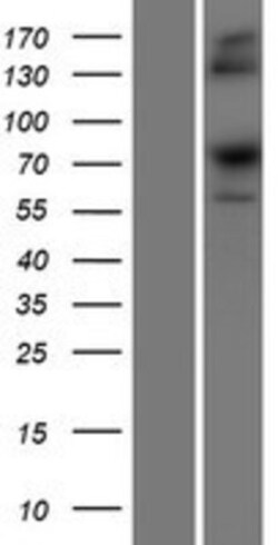 Novus Biologicals&trade;&nbsp;SRP68 Overexpression Lysate