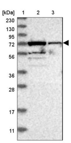 SRP68 Antibody, Novus Biologicals 25 &mu;L; Unlabeled:Antibodies, Polyclonal