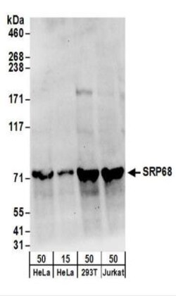 SRP68 Antibody, Novus Biologicals 0.1mg; Unlabeled:Antibodies, Polyclonal