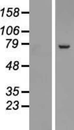 Novus Biologicals&trade;&nbsp;SRP72 Overexpression Lysate