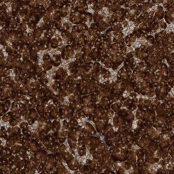 SRP72 Antibody, Novus Biologicals 25 &mu;L; Unlabeled:Antibodies, Polyclonal