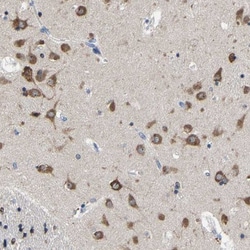 SRPK2 Antibody, Novus Biologicals 0.1mL; Unlabeled:Antibodies, Polyclonal