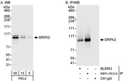 SRPK2 Antibody, Novus Biologicals 0.1mL; Unlabeled:Antibodies, Polyclonal