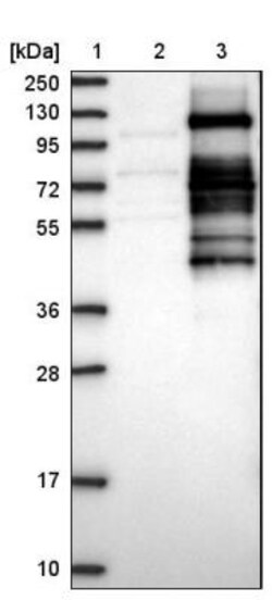 SRPK2 Antibody, Novus Biologicals 0.1mL; Unlabeled:Antibodies, Polyclonal