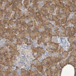 SRPRB Antibody, Novus Biologicals:Antibodies:Primary Antibodies