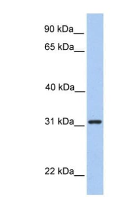 SRPRB Antibody, Novus Biologicals:Antibodies:Primary Antibodies