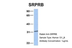 SRPRB Antibody, Novus Biologicals:Antibodies:Primary Antibodies