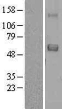 Novus Biologicals&trade;&nbsp;SRPX Overexpression Lysate