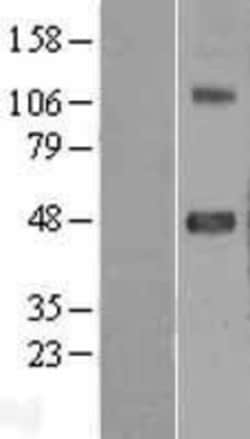 Novus Biologicals™ SRPX2 Overexpression Lysate