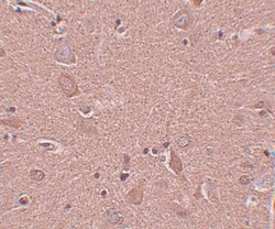 SRPX Antibody - BSA Free, Novus Biologicals 0.1mg; Unlabeled:Antibodies,