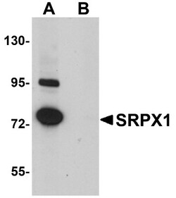 SRPX Antibody - BSA Free, Novus Biologicals 0.1mg; Unlabeled:Antibodies,