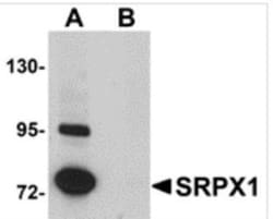 Novus Biologicals&trade;&nbsp;SRPX Antibody Blocking Peptide