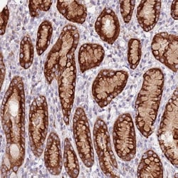 SRRM5 Antibody, Novus Biologicals 25 &mu;L, Unlabeled:Antibodies, Polyclonal