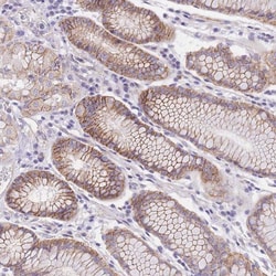 SRrp35 Antibody, Novus Biologicals:Antibodies:Primary Antibodies
