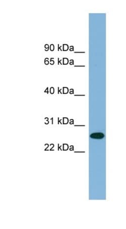 SRrp35 Antibody, Novus Biologicals:Antibodies:Primary Antibodies