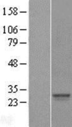 Novus Biologicals&trade;&nbsp;SRY Overexpression Lysate