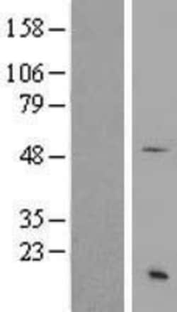 Novus Biologicals&trade;&nbsp;SS18 Overexpression Lysate