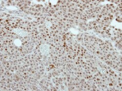 SS18L1 Antibody, Novus Biologicals 0.1mL; Unlabeled:Antibodies, Polyclonal