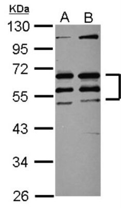 SS18L1 Antibody, Novus Biologicals 0.1mL; Unlabeled:Antibodies, Polyclonal