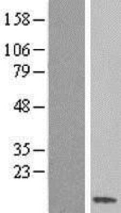 Novus Biologicals&trade;&nbsp;SS18L2 Overexpression Lysate