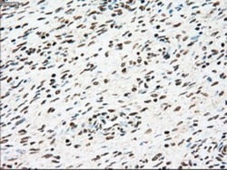 SSB Antibody (OTI2C8), Novus Biologicals 0.1mL; Unlabeled:Antikörper