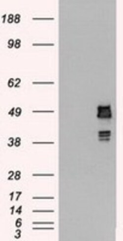 SSB Antibody (OTI2C8), Novus Biologicals 0.1mL; Unlabeled:Antikörper