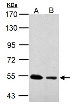 SSB Antibody, Novus Biologicals 0.1mL; Unlabeled:Antibodies, Polyclonal