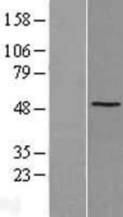 Novus Biologicals™ SSB Overexpression Lysate