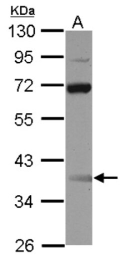 SSBP3 Antibody, Novus Biologicals 0.1mL; Unlabeled:Antibodies, Polyclonal