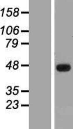 Novus Biologicals&trade;&nbsp;SSBP3 Overexpression Lysate