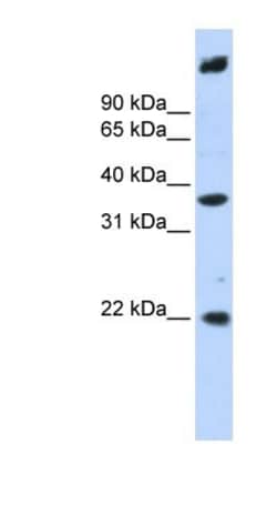 SSBP3 Antibody, Novus Biologicals:Antibodies:Primary Antibodies