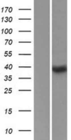 Novus Biologicals&trade;&nbsp;SSBP4 Overexpression Lysate