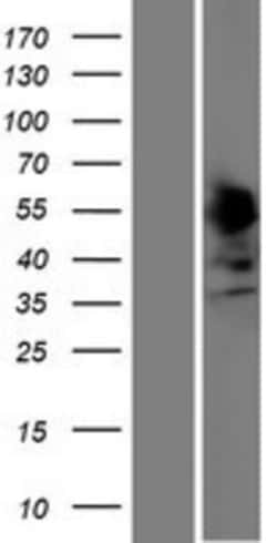 Novus Biologicals&trade;&nbsp;SSBP4 Overexpression Lysate