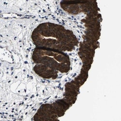 SSH3 Antibody, Novus Biologicals 0.1mL; Unlabeled:Antibodies, Polyclonal