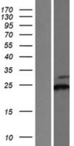 Novus Biologicals SSR2 Overexpression Lysate 0.1 mg | Buy Online | Novus Biologicals&trade; | Fisher Scientific