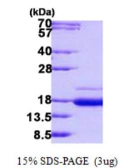 Novus Biologicals&trade;&nbsp;Recombinant Human SSR2 His Protein