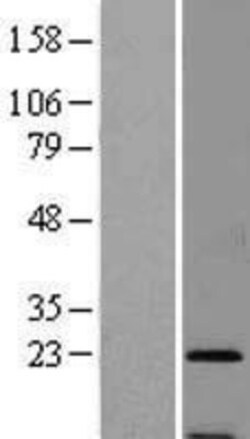 Novus Biologicals&trade;&nbsp;SSR3 Overexpression Lysate
