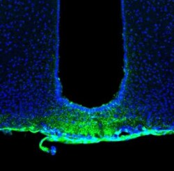 SSR3 Antibody, Novus Biologicals 0.1mL; Unlabeled:Antibodies, Polyclonal