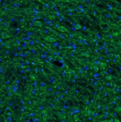 SSR3 Antibody, Novus Biologicals 0.1mL; Unlabeled:Antibodies, Polyclonal