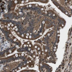 SSR3 Antibody, Novus Biologicals 0.1mL; Unlabeled:Antibodies, Polyclonal