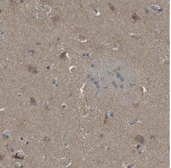 SSR3 Antibody, Novus Biologicals 0.1mL; Unlabeled:Antibodies, Polyclonal