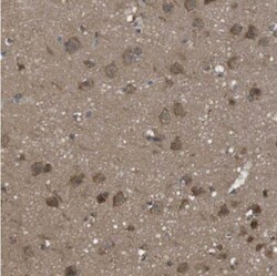 SSR3 Antibody, Novus Biologicals 0.1mL; Unlabeled:Antibodies, Polyclonal