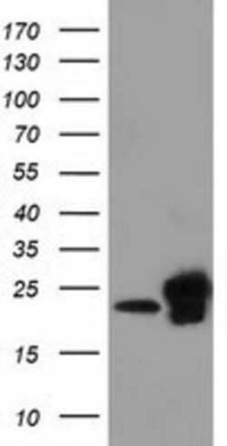 SSSCA1 Antibody (OTI2F5), Novus Biologicals 0.1mL; Unlabeled:Antibodies,